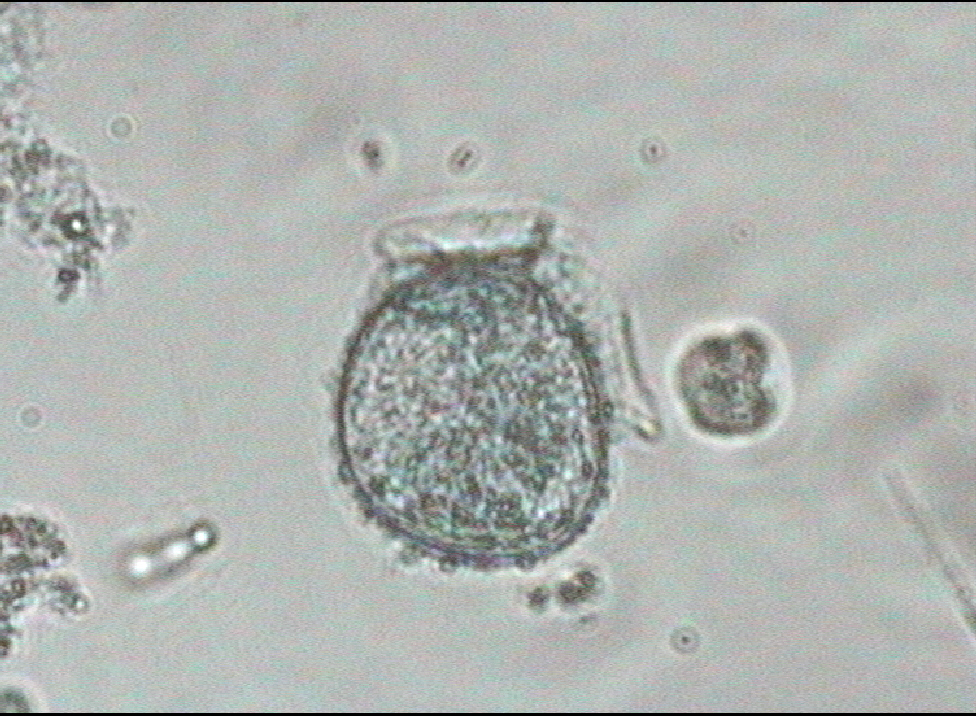 Dictyocha speculum